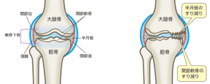 膝関節の構造